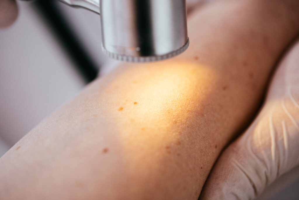 Houston Skin Cancer Screening Houston Laser Skin Center