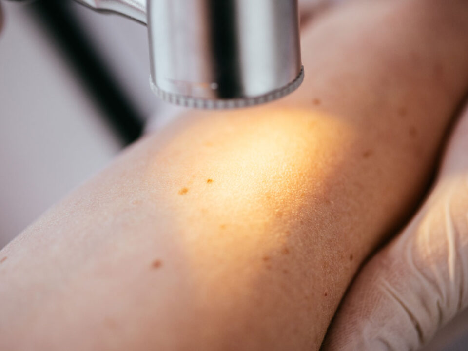 Houston Skin Cancer Screening